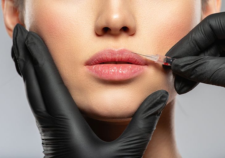 Close-up of a person receiving a lip injection with a syringe, administered by hands wearing black gloves—a hallmark service of our botox-based business.
