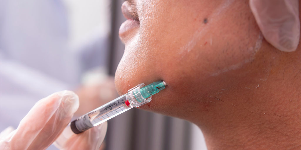 A medical professional wearing gloves administers an injection into the lower jaw of a patient.