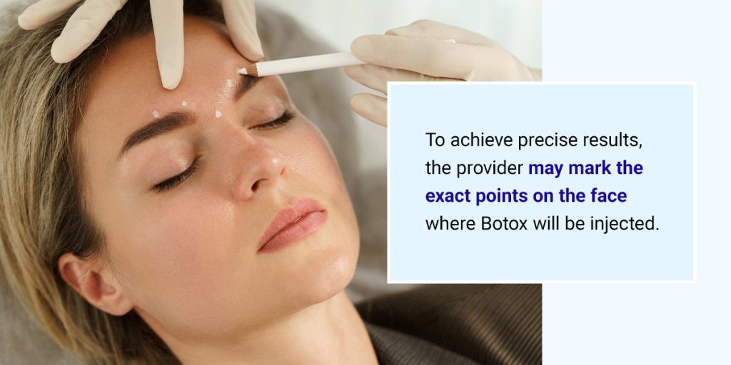 Person with closed eyes lying down, receiving Botox markings on forehead by gloved hands, accompanied by text about precise injection points.