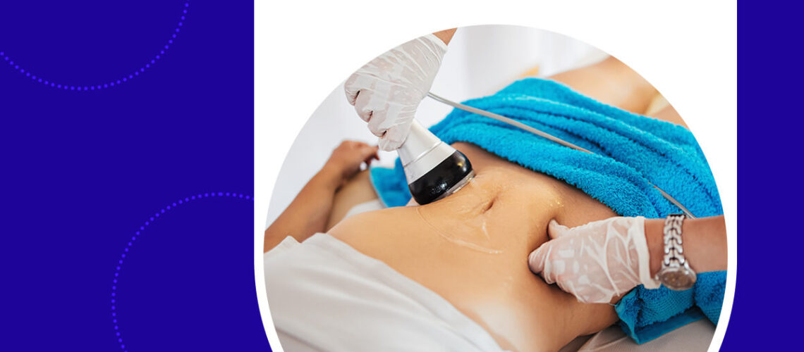how to prepare patients for liposuction surgery